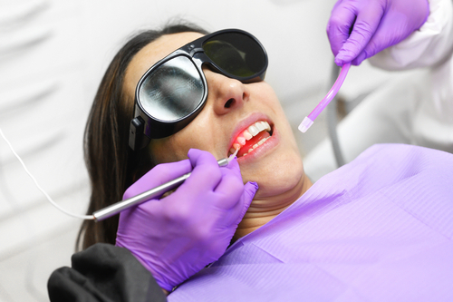 Laser Dentistry in Huntsville, AL Chase Family Dentistry